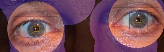 Avansert programvare: Programvaren Volk Eye Check i mobiltelefonen kan ut fra pupillenes posisjon, refleksen i pupillene og flere andre anatomiske parametere regne ut vinkelen mellom øynene.