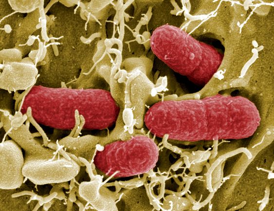 FARLIG: Flere har utviklet den farlige sykdommen HUS i nyrene etter å ha blitt smittet av E.coli-bakterien EHEC.