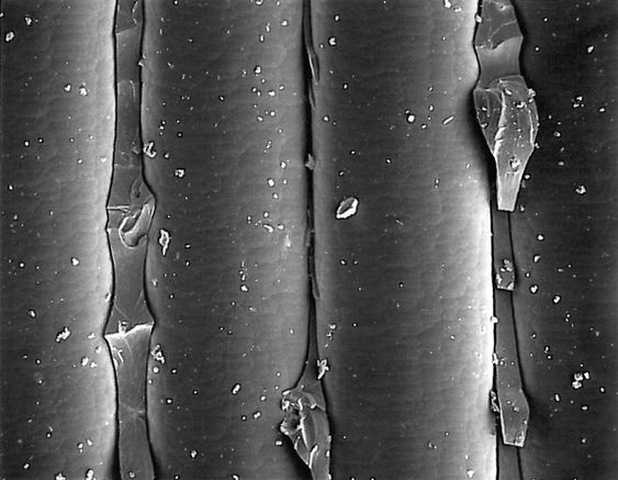 Mikroskopbilde av Oddvar Brå-stav