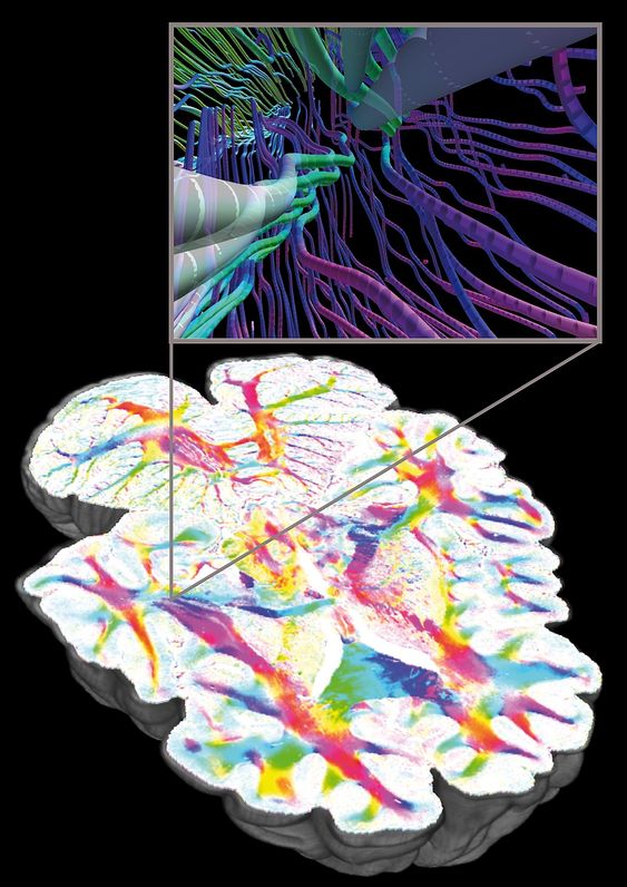 Zoom into a 3D reconstruction of a human brain based on Polarized Light Imaging, Forschungszentrum Jülich, Germany 