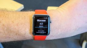 Rett pa Apple Watch: De som vil ha en smartklokke kan få verdiene fra sensoren rett inn på klokka over Bluetooth.