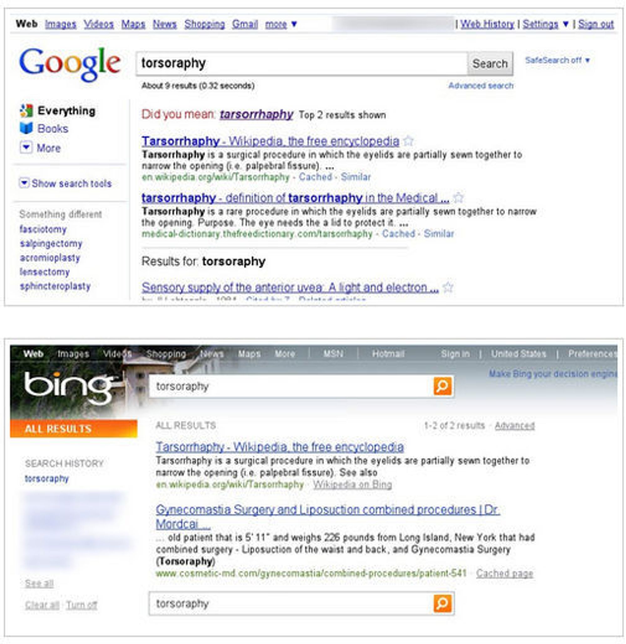 Sammenligning av resultatene i Google Search og Bing ved søk etter "torsoraphy". På grunn av omtalen av denne saken ser søkeresultatene helt annerledes ut nå.