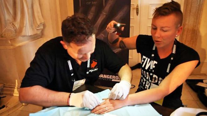 Her får norske Anita en chip sprøytet inn i hånden