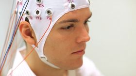EEG er undersøkelser som registrerer elektriske impulser som oppstår i hjernebarken.