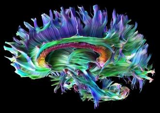Nervebaner: En MRI-maskin med raske gradienter som den Siemens nettopp har lansert kan benytte en teknologi som kalles Diffusion Tensor Imaging og som f. eks. kan vise hvordan nervebanene i hjernen går.