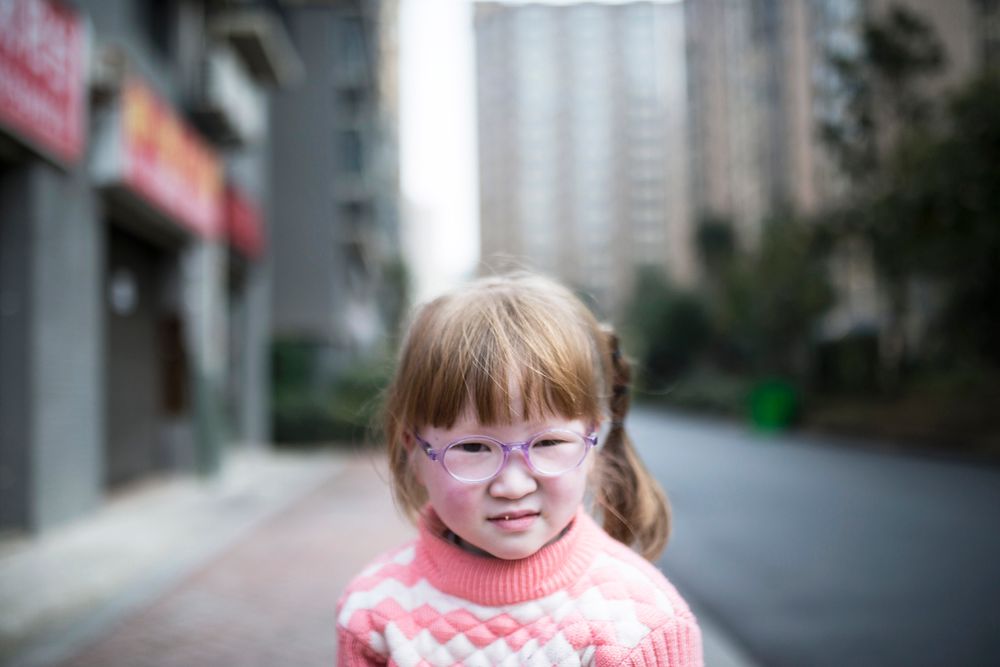 Forventningsfull: Tian Yajies mamma sier: – Jeg ønsker at min datter vokser opp sunn og glad. Jeg vil ikke tillate at andre dømmer henne på grunn av hennes tilstand eller unormale syn. Changsha, Hunan-provinsen.