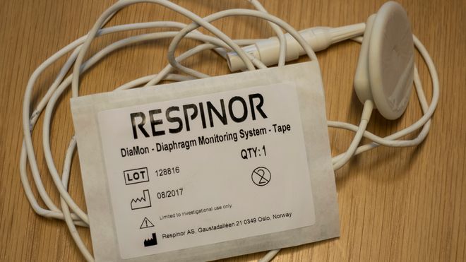3,2 millioner pasienter legges i respirator hvert år - norsk oppfinnelse gjør den rådyre behandlingen billigere