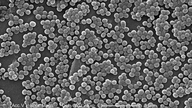 Antibiotika-forskning: Smittsomme bakterier går i dvale og våkner opp igjen