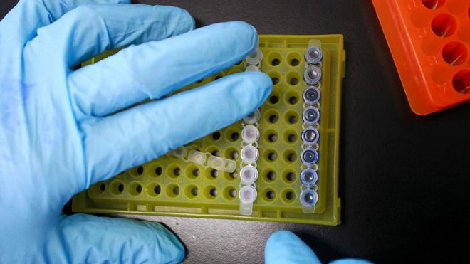 Medisinsk gjennombrudd: Hiv-positiv mann skal være kurert