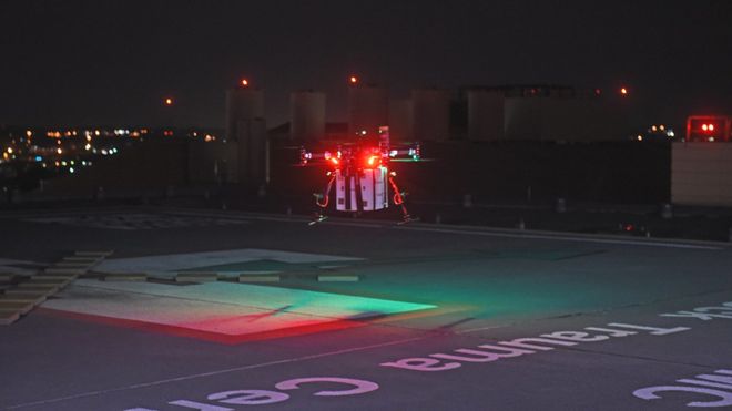 Historisk organtransplantasjon: Fikk levert ny nyre med drone