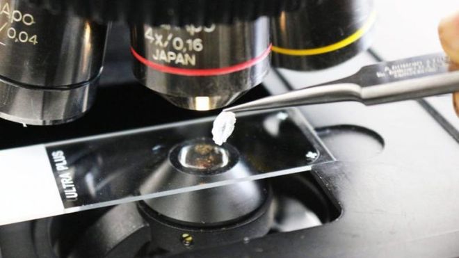 Dansk oppfinnelse skriver i 3D med kroppens egne materialer