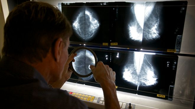 En radiolog undersøker bilder tatt ved mammografi i Los Angeles i USA.