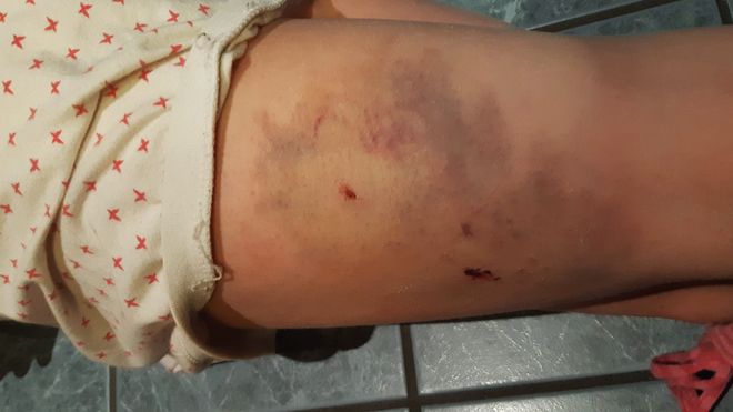 Politihund vedtatt omplassert etter å ha bitt 10-åring - Nå er den tilbake i Innlandet