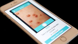 Norsk gründer avslører hudkreft med mobiltelefon