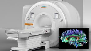 mri.300x169.jpg