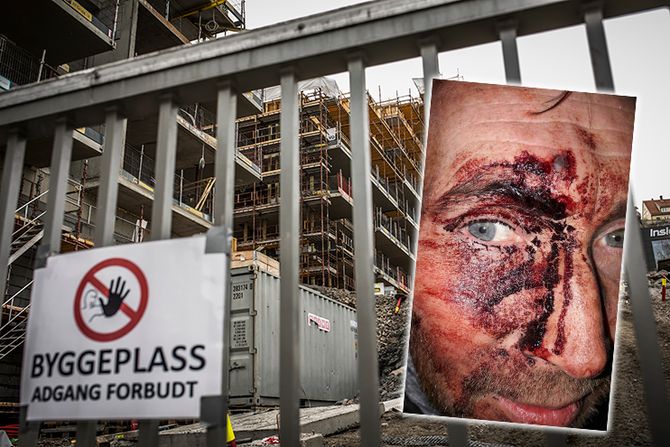 ANGREPET: Da politimannen ankom byggeplassen i Kværnerbyen i Oslo, der en innbruddsalarm hadde gått, ble han slått med en planke med spiker. FOTO: Torkjell Trædal/privat