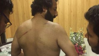 Kadafi Zaman og skadene han fikk etter politivolden.