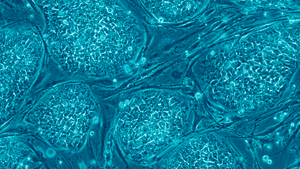 Human_embryonic_stem_cells_only_A.300x16