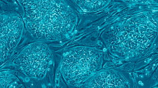 5 spørsmål og svar: Hvordan forskes det på stamceller?