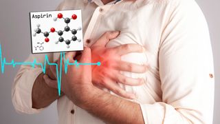 Studie: Unødvendig for friske å forebygge hjerteinfarkt med aspirin