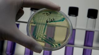En petriskål med E.coli-bakterier.