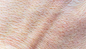 /2540/2540906/bigstock-human-skin-macro-texture-text-250205341.300x169.jpg