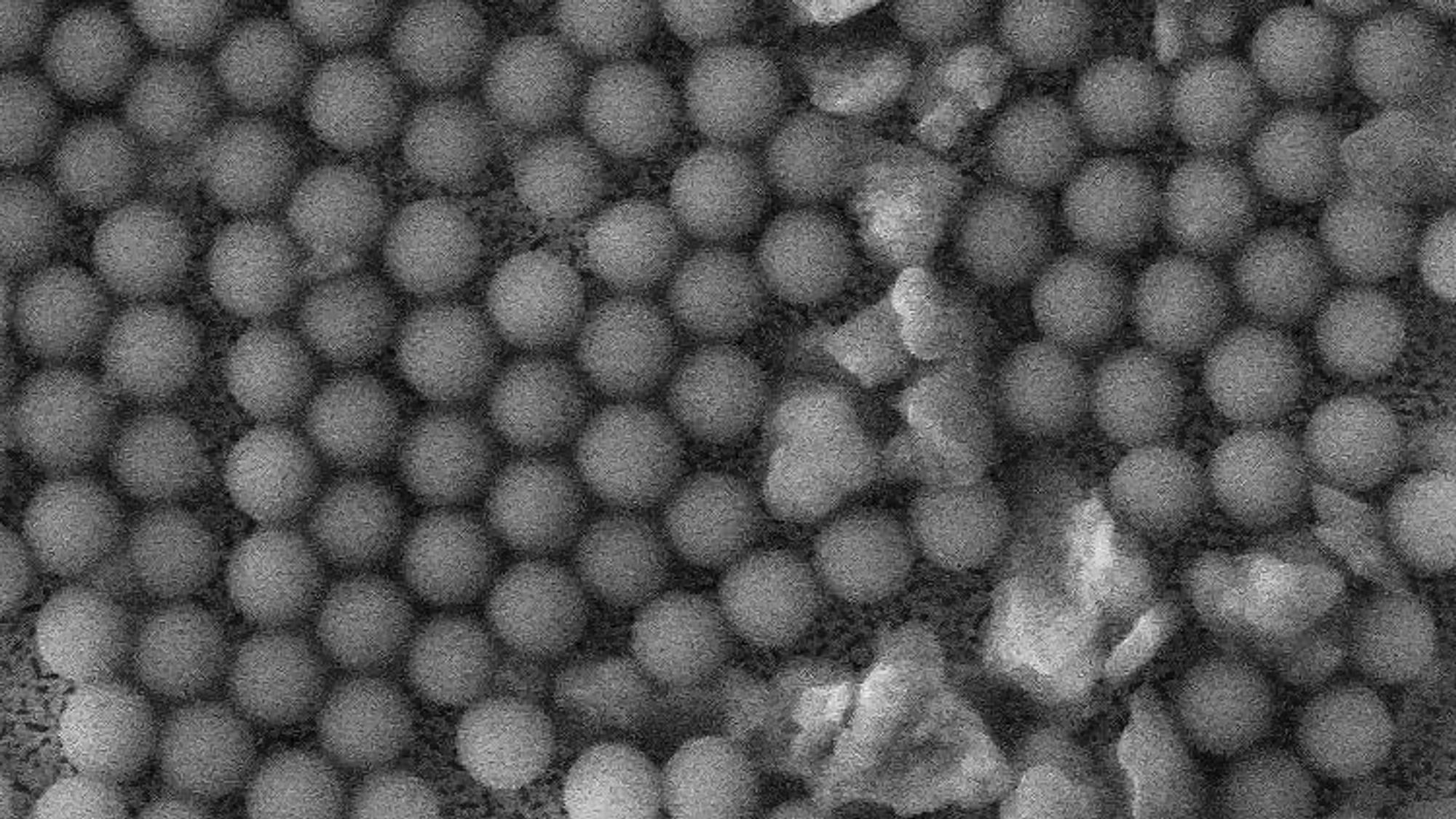 Disse ørsmå kulene - bildet er tatt med elektronmikroskop - brukes nå til å produsere test-sett for koronaviruset.