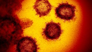 Virus er over alt - det er ufattelige antall i enhver vanndråpe. Men hvordan oppfører de seg?