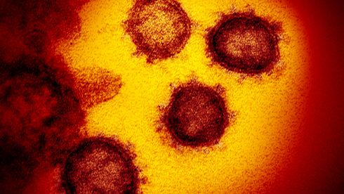 Virus er over alt - det er ufattelige antall i enhver vanndråpe. Men hvordan oppfører de seg?
