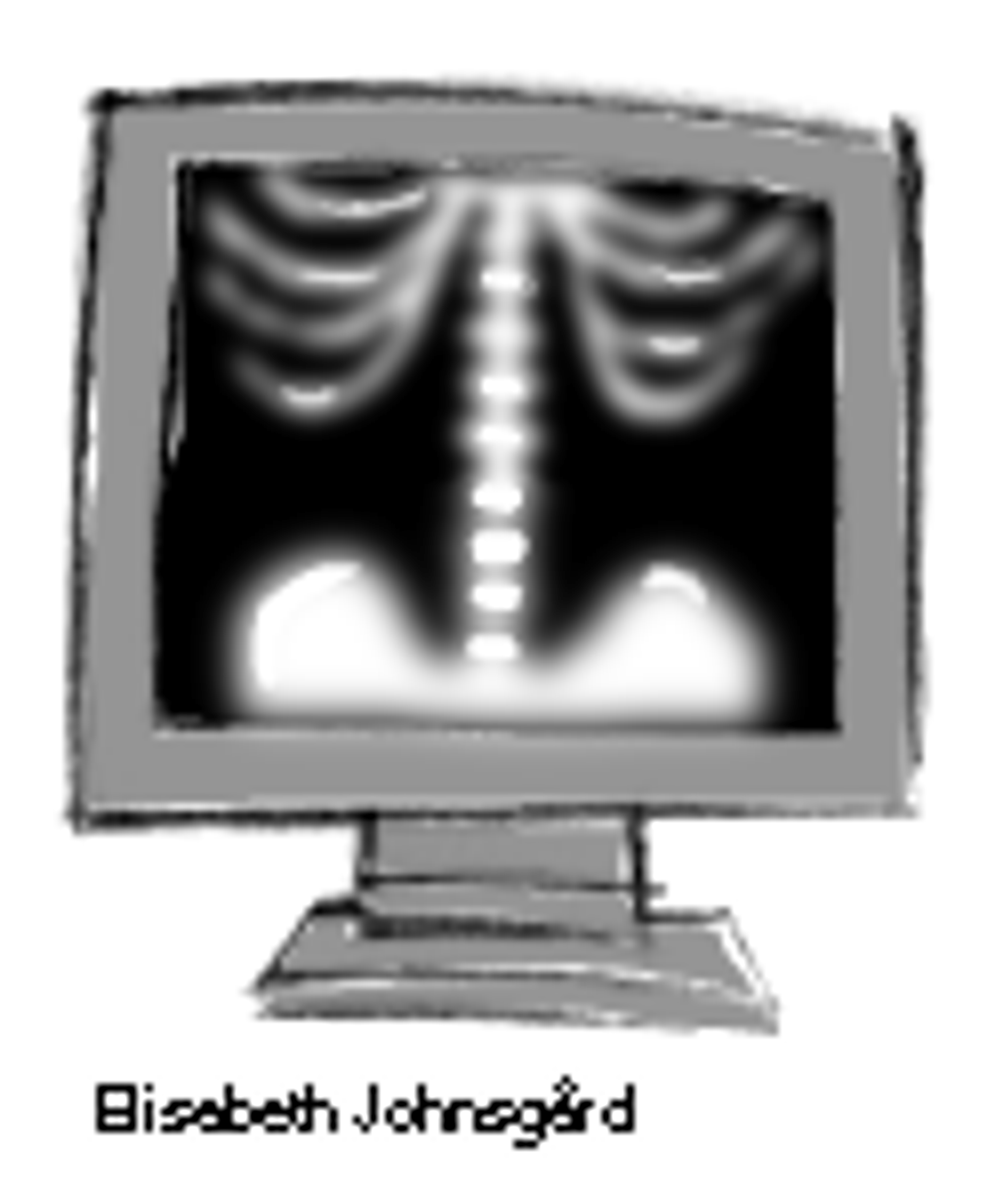 Røntgenapparat