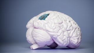 En hvit plast-hjerne med en grønn datamaskin-chip satt inn i hjernebarken