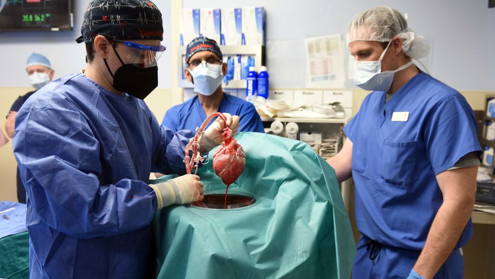 Kirurger ved University of Maryland School of Medicine viser fram grisehjertet som ble transplantert inn i pasienten fredag 7. januar.