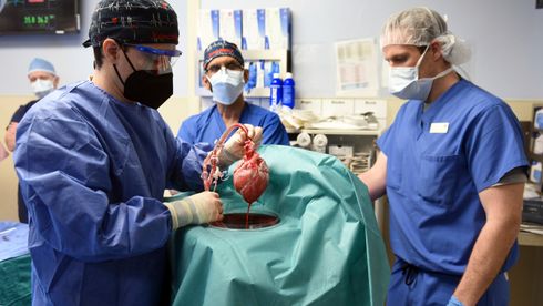 Kirurger ved University of Maryland School of Medicine viser fram grisehjertet som transplanteres inn i pasienten i Baltimore fredag 7. januar.
