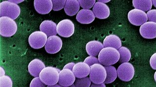 Forskarar driv kjemisk detektiv­arbeid for å bekjempa antibiotika­resistens