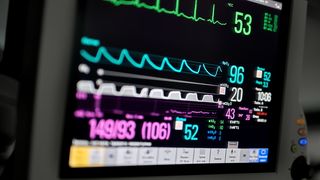 En skjerm på et sykehus viser puls, oksygenmetning og så videre for en pasient.