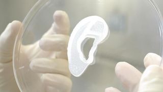 Se før og etter: Amerikaner har fått verdens første transplantasjon av et 3D-printet øre