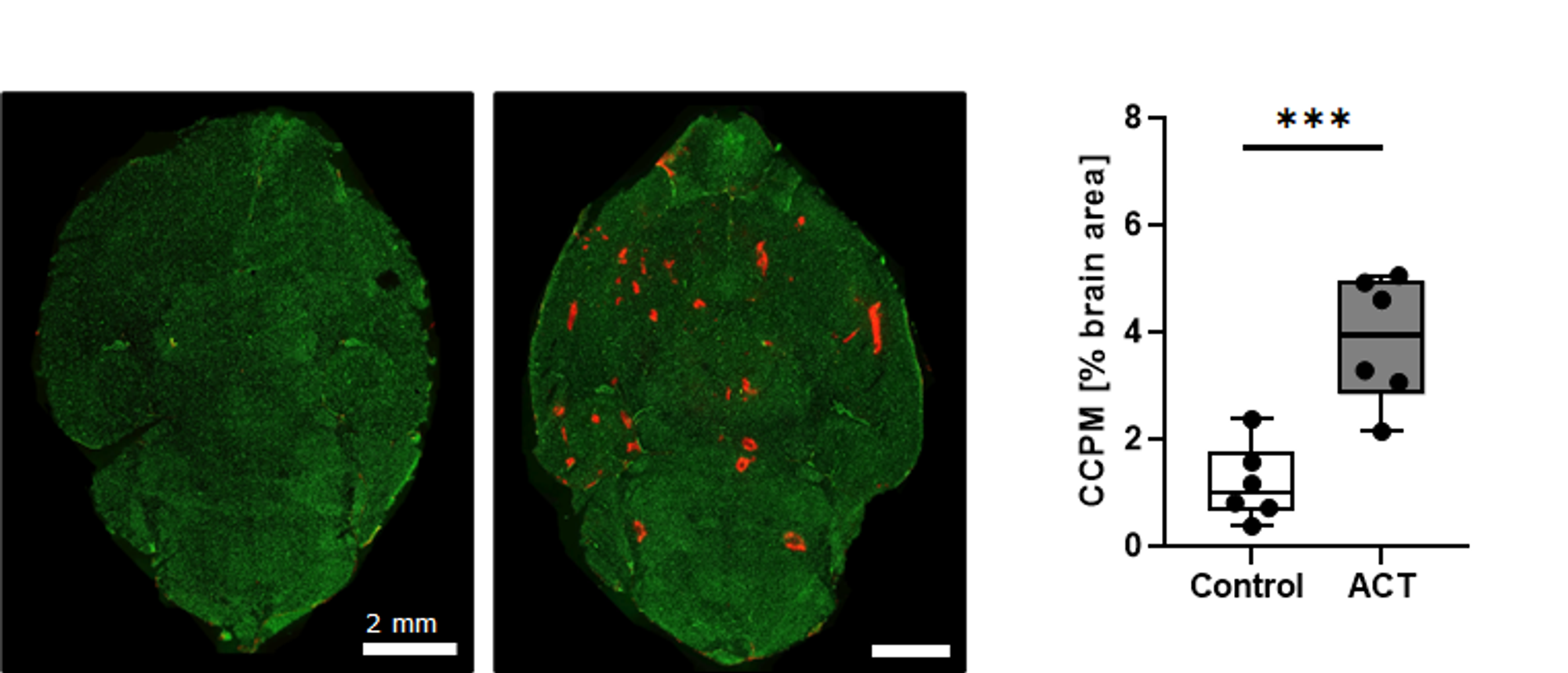 Figuren viser røde nanopartikler som har passert blod-hjernebarrieren (farget i grønn) og kommet inn i hjernevevet etter ACT-behandling .