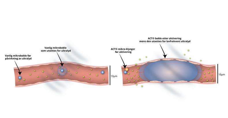 Tegning som viser prinsippet for «Acoustic Cluster Therapy», ACT.